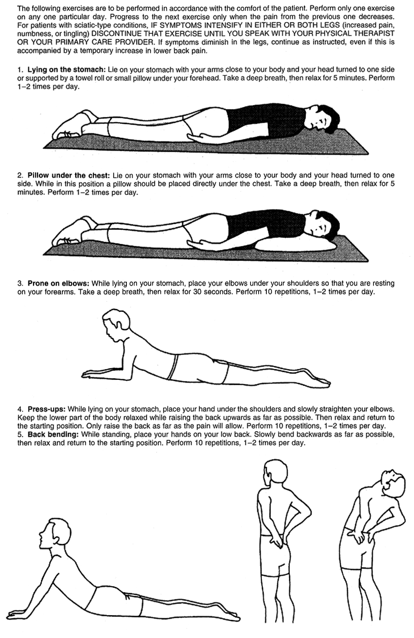 mckenzie exercises for sciatica