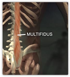 multifidus strengthening