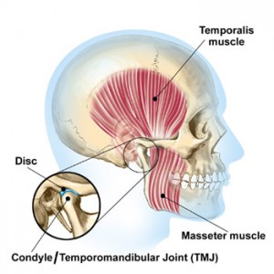 bloomington il chiropractor, jaw pain